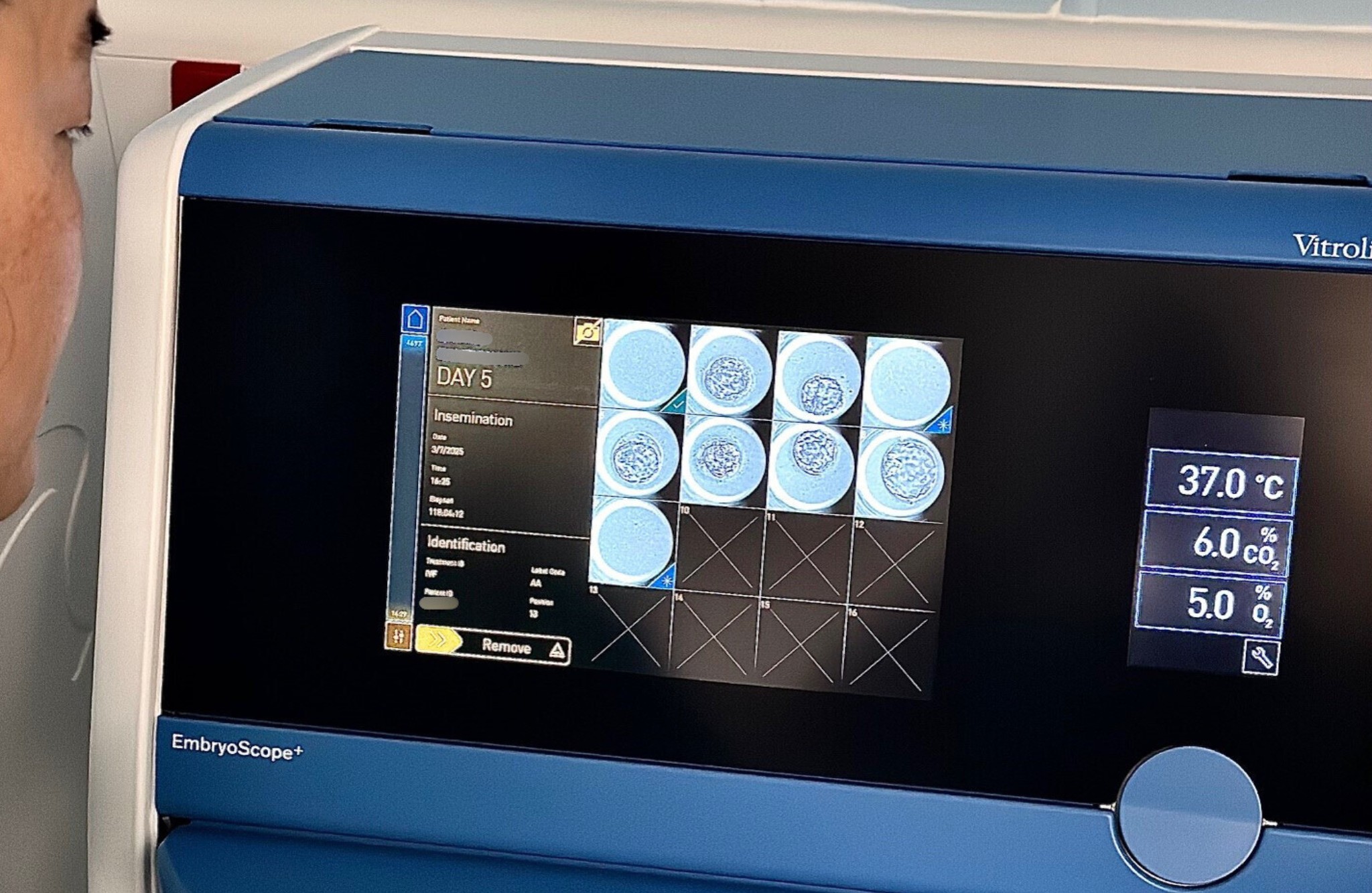 How technology is transforming fertility care